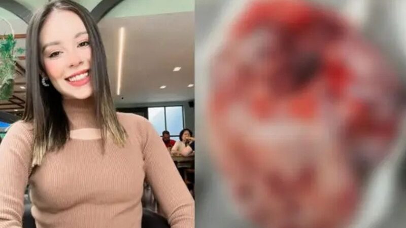 Jovem de Manaus luta contra câncer agressivo e precisa de ajuda urgente