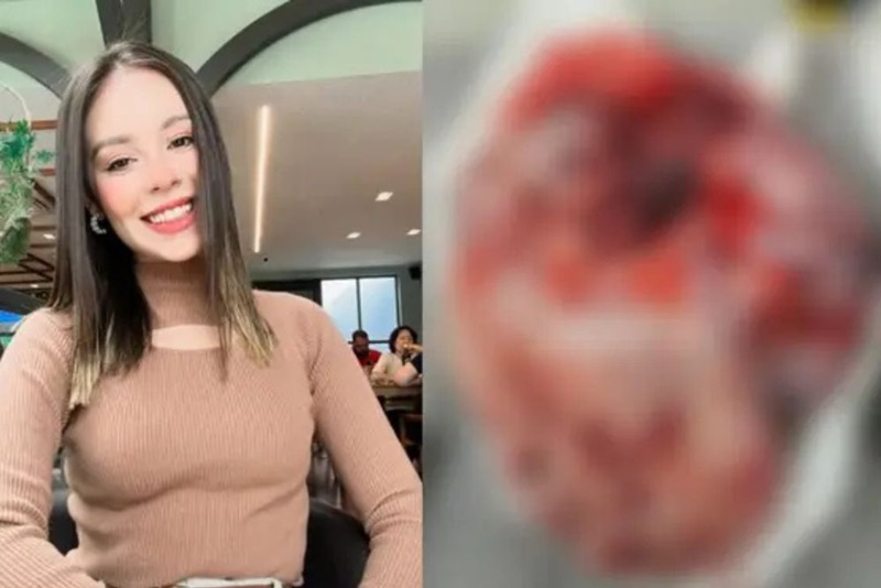 Jovem de Manaus luta contra câncer agressivo e precisa de ajuda urgente